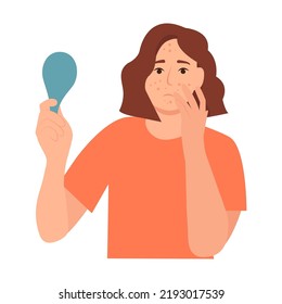 La joven tiene problemas de piel, acné, granos, cabezas negras y manchas. Cuidado de la piel y dermatología. Piel adolescente. Ilustración vectorial plana