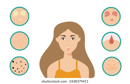 Young girl has skin problems with acne or allergic pimples on her face. Skincare and dermatology concept. Flat style vector illustration.