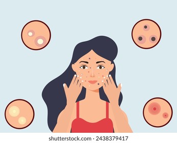 Young girl has skin problems with acne or allergic pimples on her face. Skincare and dermatology concept. Flat style vector illustration.