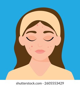 Young girl has skin problems with acne or allergic pimples on her face. Skincare and dermatology concept. Flat style vector illustration.