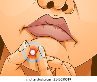 The young girl with skin problems. Pimple-popping. Pimple problems. Healthcare illustration. Vector illustration.