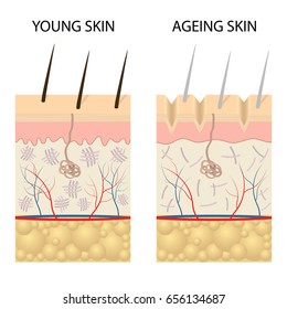 Young Healthy Skin Older Skin Comparison Stock Vector (Royalty Free ...