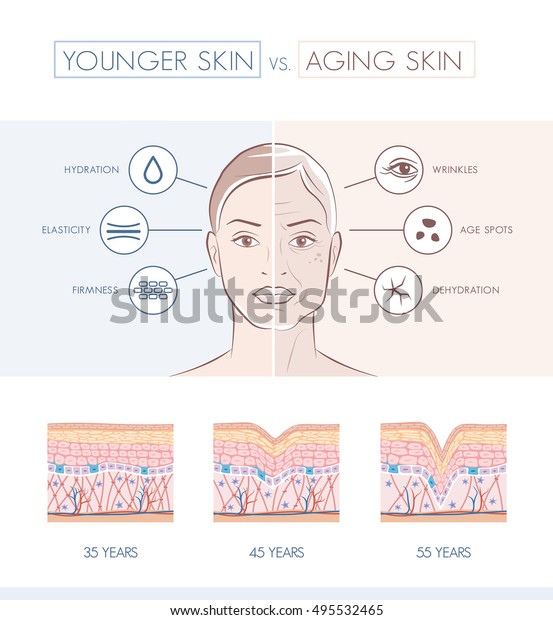 Young healthy skin and older skin comparison,\
skin layers and wrinkles\
diagram