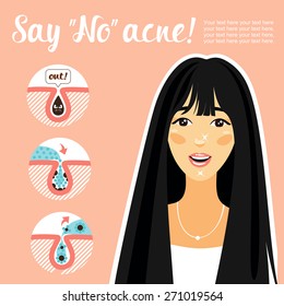 Young Korean girl with perfect skin. Poster about the shortcomings of the skin and their destruction. Say no to acne! icons skin incision