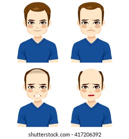 Young male with different stages of hair loss