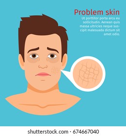 Young Man Face With Dry Skin Problem, Vector Illustration