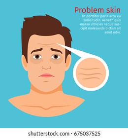 Young man face problem skin with wrinkles, vector illustration