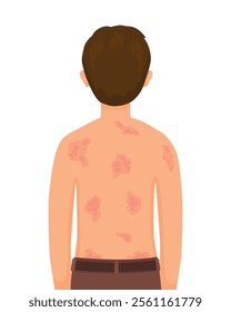 young man having itchy back with rash, allergy, dermatitis, skin inflammation, redness and irritation