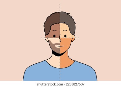 Young man with parts of different skin color show diversity and unity. Male portrait demonstrate community multinationalism and equality. Vector illustration. 