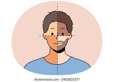 Young man with parts of different skin color show diversity and unity. Male portrait demonstrate community multinationalism and equality. Vector illustration.