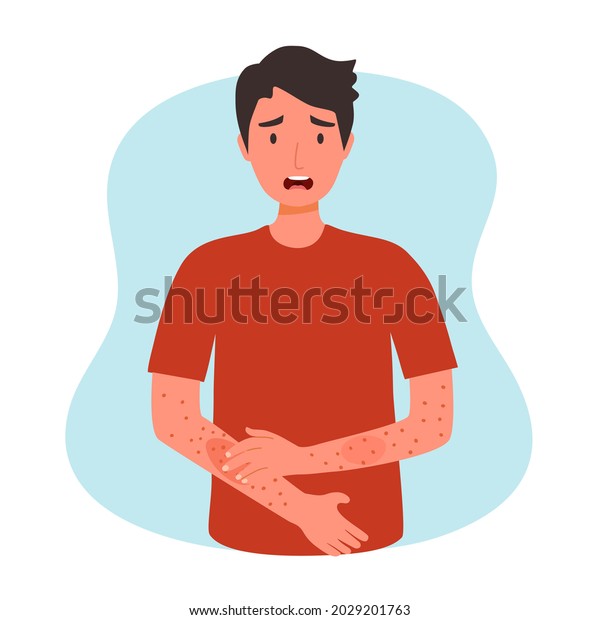 Young Man Scratching Arm Guy Suffering Stock Vector (Royalty Free ...