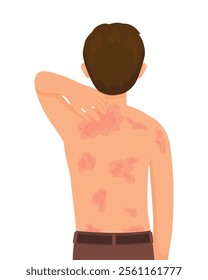 young man scratching his itchy back with rash, allergy, dermatitis, skin inflammation, redness and irritation