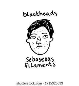a young man with skin problems. hand drawn vector illustration: character with blackheads, sebaseous filaments, inflammation on the skin. dermatological and cosmetological clipart.