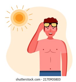 Young man with skin sunburn under strong sunlight in flat design.