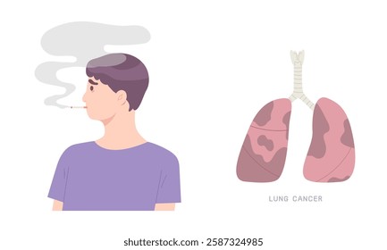 Young man is smoking with lung cancer isolated on white background. Concept of respiratory system, unhealthy lifestyle, medicine, disease, illness, tabacco. No Smoking Day. Flat vector illustration.