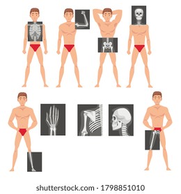 Young Man Standing in Undershorts with His Skeleton X-ray Presented on Monitor Vector Set