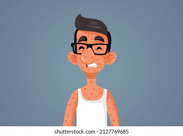 

Young Man Suffering from Measles Vector Cartoon Illustration. Teenager getting a viral disease suffering from the symptoms
