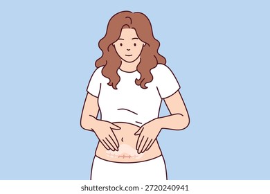 Una madre joven realiza un masaje abdominal después de la cirugía de cesárea utilizando ungüento médico para la recuperación de la piel. Concepto de salud posparto, cuidado de heridas quirúrgicas y aceptación del cuerpo femenino.