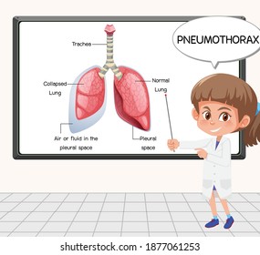 Young scientist explain pneumothorax in front of a board in laboratory illustration