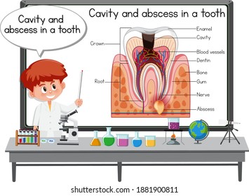 Científico joven explicando cavidad y absceso en un diente en la ilustración de laboratorio