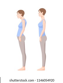 Young Smiling Woman Standing In Good And Bad Postures Isolated On White Background. Neutral Spine, Correct And Incorrect Poses. Side View. Colorful Vector Illustration In Flat Cartoon Style