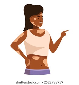 Young smiling woman with vitiligo is pointing with her finger to the side, isolated on white background