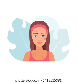 Young woman with acne puberty problem and red pimples on face vector illustration