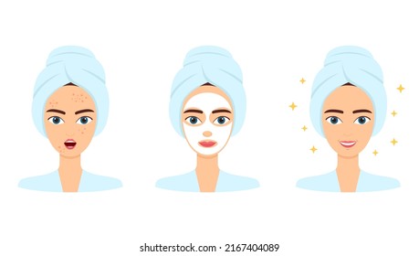 Young woman with acne. Treatment, before and after skincare. Face mask, beauty concept, vector illustration