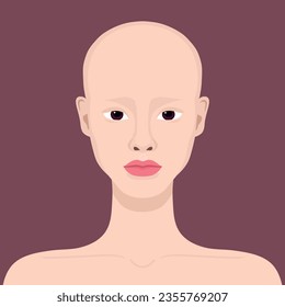 Young woman with alopecia. Beautiful bald girl. Alopecia areata. Vector illustration