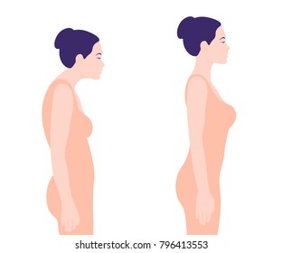 Young woman with bad posture. Spine. Profile. Vector illustration on white background. Minimalism