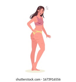 Young woman with cellulite on her thighs. Girl in underwear with skin problem on her leg. Overweight body. Isolated vector illustration in cartoon style