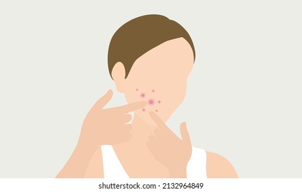 Young woman face with skin acne, pimples, blackheads vector illustration. Acne skin face problem concept