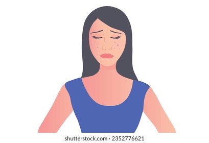 Young woman face with skin acne, pimples, blackheads vector illustration. Acne skin face problem concept