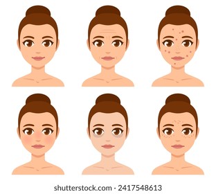 Young woman face with skin concerns. Wrinkles, acne, pigmentation spots, dark circles. Health and beauty illustration, skincare vector set.