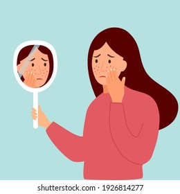 Young Woman Hand Mirror Worrying About Her Acne On Face In Flat Design. Pimple Problem On Female Skin.