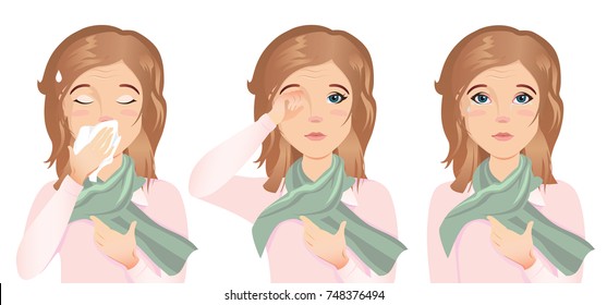 Young woman has an allergy, runny nose, cough, itching eyes, red eyes, watery eyes, tears. She is sick. / Flat design, vector cartoon illustration on a white background. 