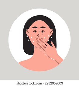 Las mujeres jóvenes tienen problemas con la erucción, las hembras cogen la mano cerca de su boca. Chica en llamas. Graciosa ilustración médica vectorial plana.