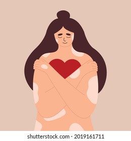 Young woman with psoriasis skin disease, girl with vitiligo hugs herself and her body. He holds a heart in his hands. Love yourself, self confidence and care. Accept yourself, body positive. Vector.