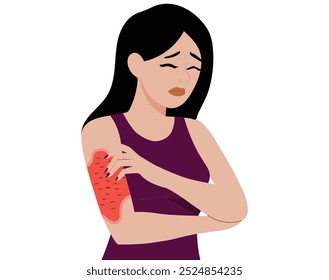 Young woman Red rash skin flat vector illustration