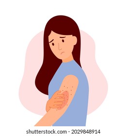Young woman scratching arm. Female  suffering from strong allergy skin itchy symptom in flat design. Red rash skin irritation.