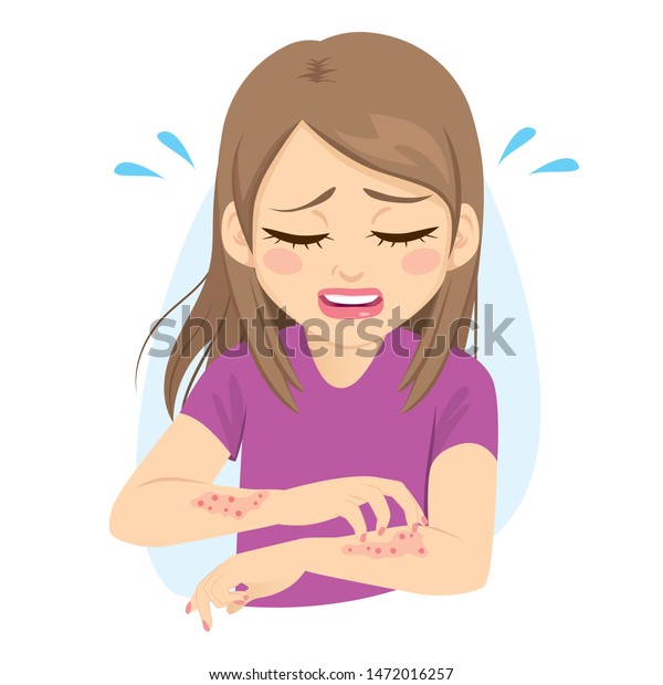 強いアレルギーの皮膚の痒みを感じる腕を掻く若い女性 のベクター画像素材 ロイヤリティフリー