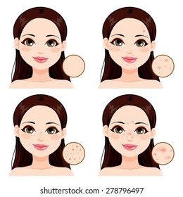 Young woman showing the effects different skin health problems compared to clean skin and freckles