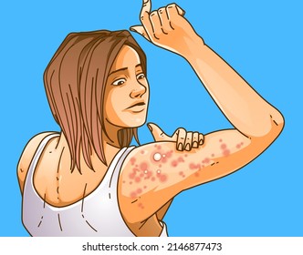 A Young Woman With Skin Problems On Her Body.  Pimple Problems. Rash Problems. Healthcare Illustration. Vector Illustration.