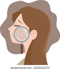 Young woman suffering from dry skin