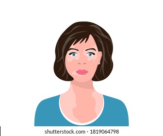 Young woman with vitiligo. Close-up portrait of a woman with skin problems. Female character with vitiligo. Vector illustration on white isolated background.