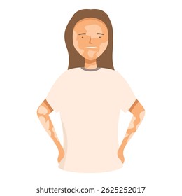 Young woman with vitiligo skin condition smiling and posing confidently