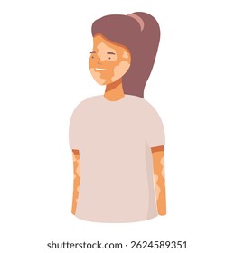 Young woman with vitiligo smiling and feeling confident about her body