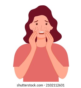 Young woman worrying about her acne on face in flat design. Pimple problem on female skin.