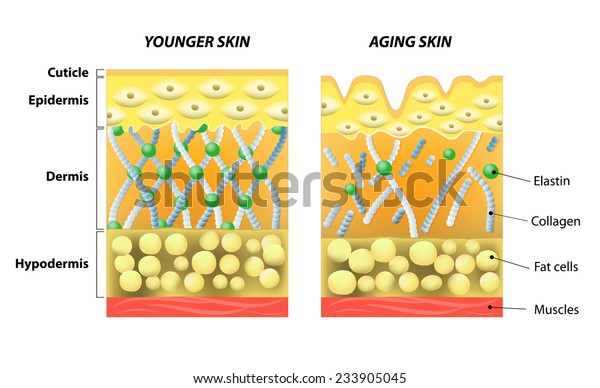 younger skin and aging skin.\
elastin and collagen. A diagram of younger skin and aging skin\
showing the decrease in collagen and broken elastin in older\
skin.