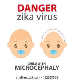 Zika symptom graphic design, Vector illustration